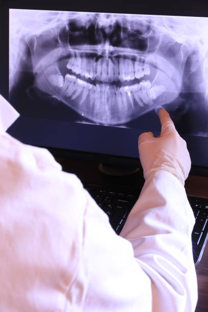 Best Emergency Tooth Extraction in Oxford, AL